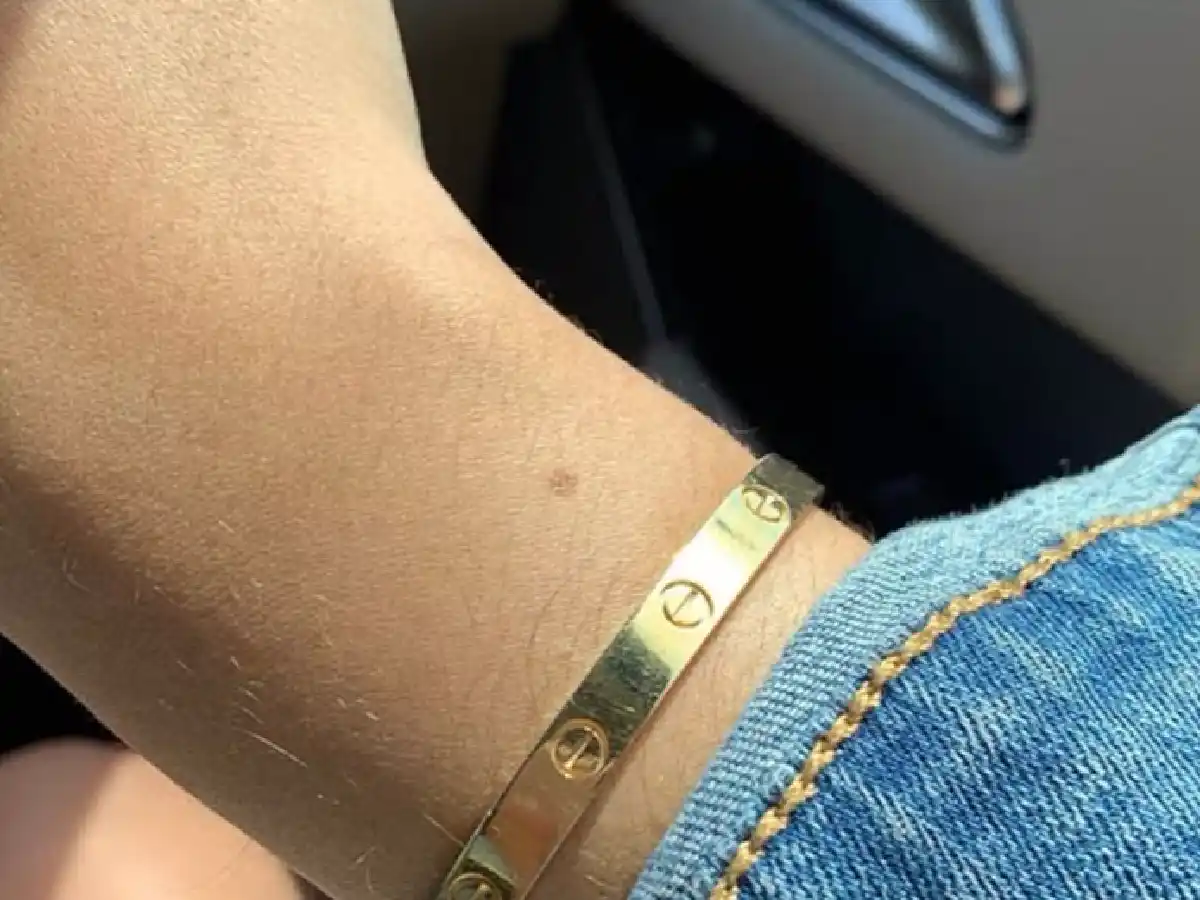 El enigma viral que asegura que todas las mujeres tienen un lunar en la muñeca