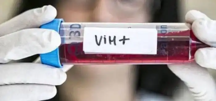 Gen hallado en monos y  ratones podría bloquear  el VIH y el ébola