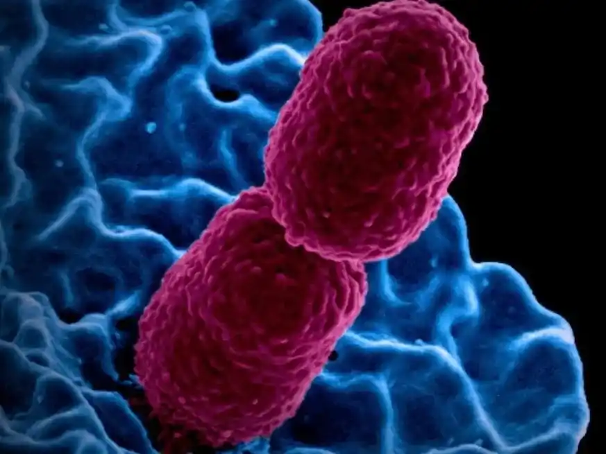Bacteria Klebsiella pneumoniae. Crédito: NIAID