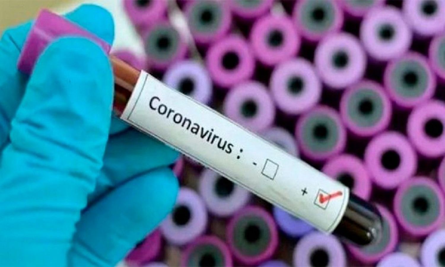 Segundo muerto por coronavirus en Argentina: estaba internado en Chaco