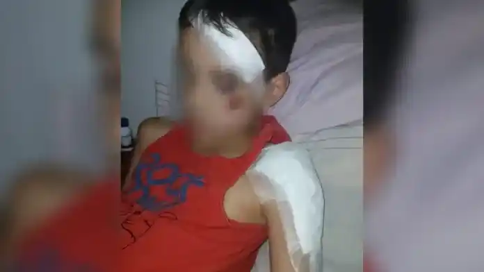 Denuncian que un motociclista imprudente atropelló a un niño