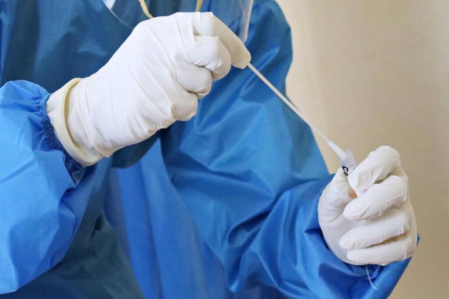 Confirmaron el primer caso de viruela del mono en la Argentina