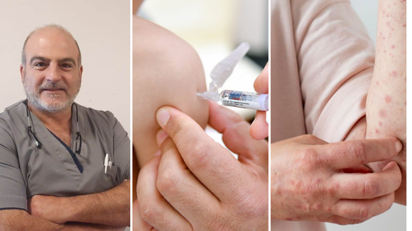 Sarampión: para prevenir, Guerra pidió cumplir con las vacunas