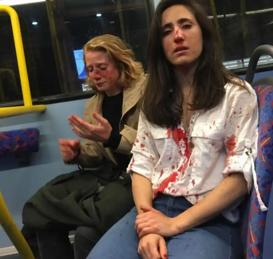 El relato de la uruguaya a la que golpearon junto a su novia en un ómnibus de Londres