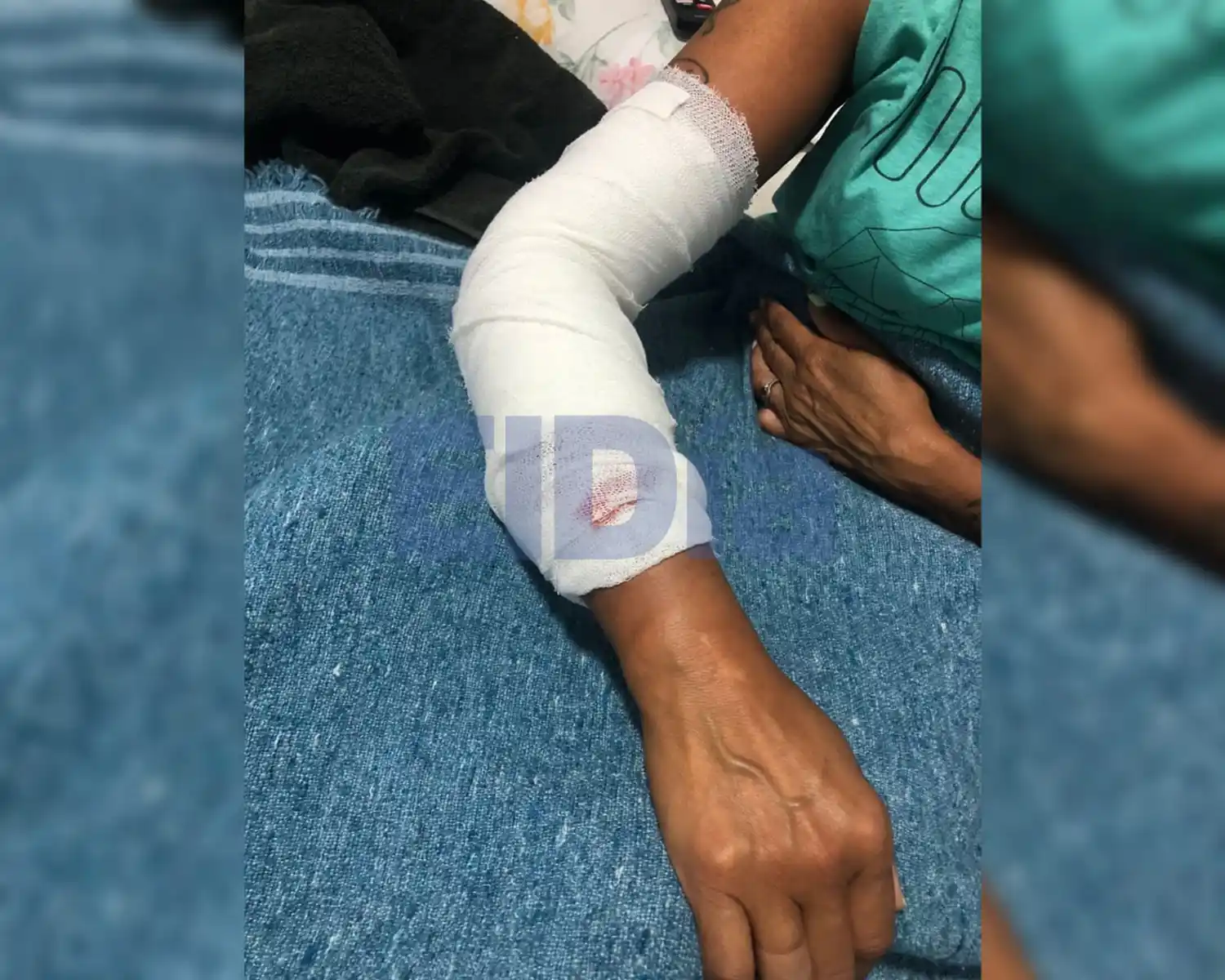 Feroz ataque de un perro a una mujer: "Es un dolor insoportable"