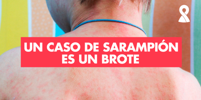 Entidades científicas alertan sobre el brote de sarampión en Argentina