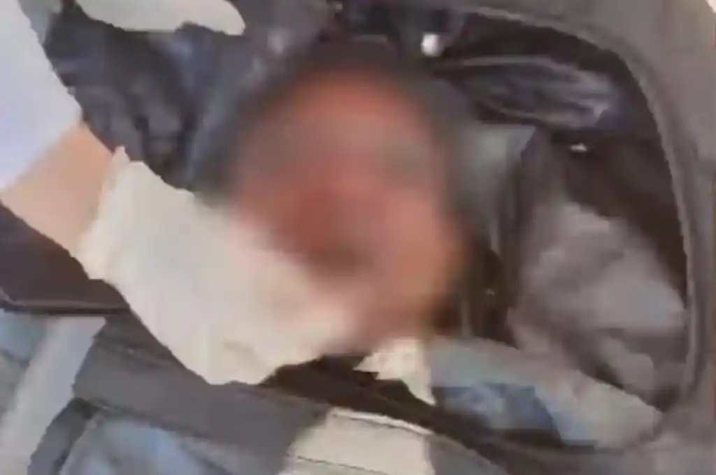 La cabeza fue trasladada a la Morgue de San Martín.