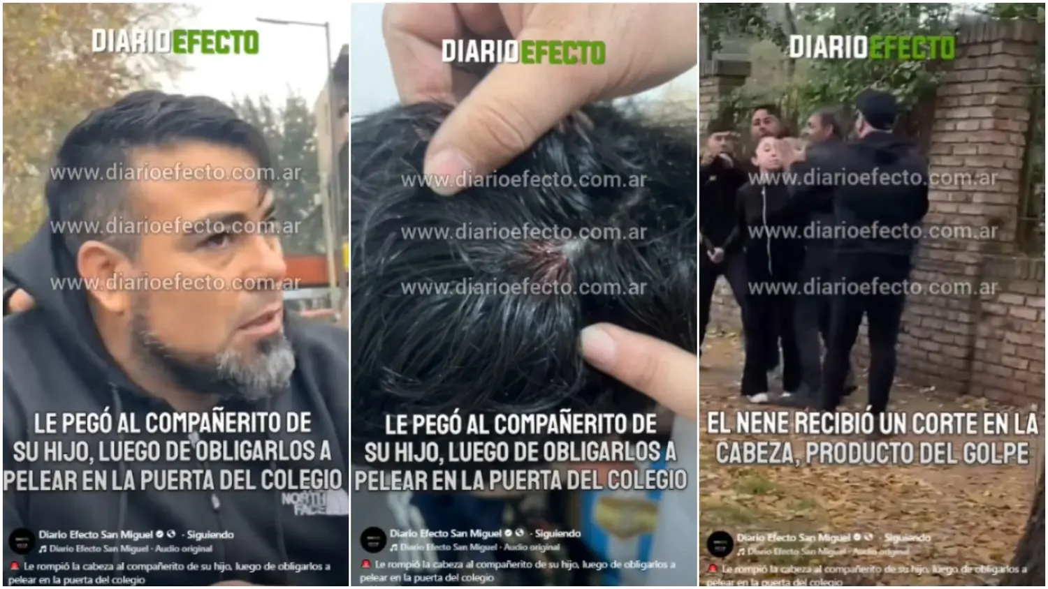 Un hombre golpeó a un compañero de su hijo de 14 años en la puerta de un colegio en San Miguel y le rompió la cabeza