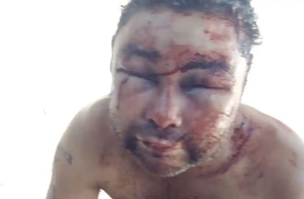 Un hombre quedó detenido por la salvaje golpiza contra su hermanastro