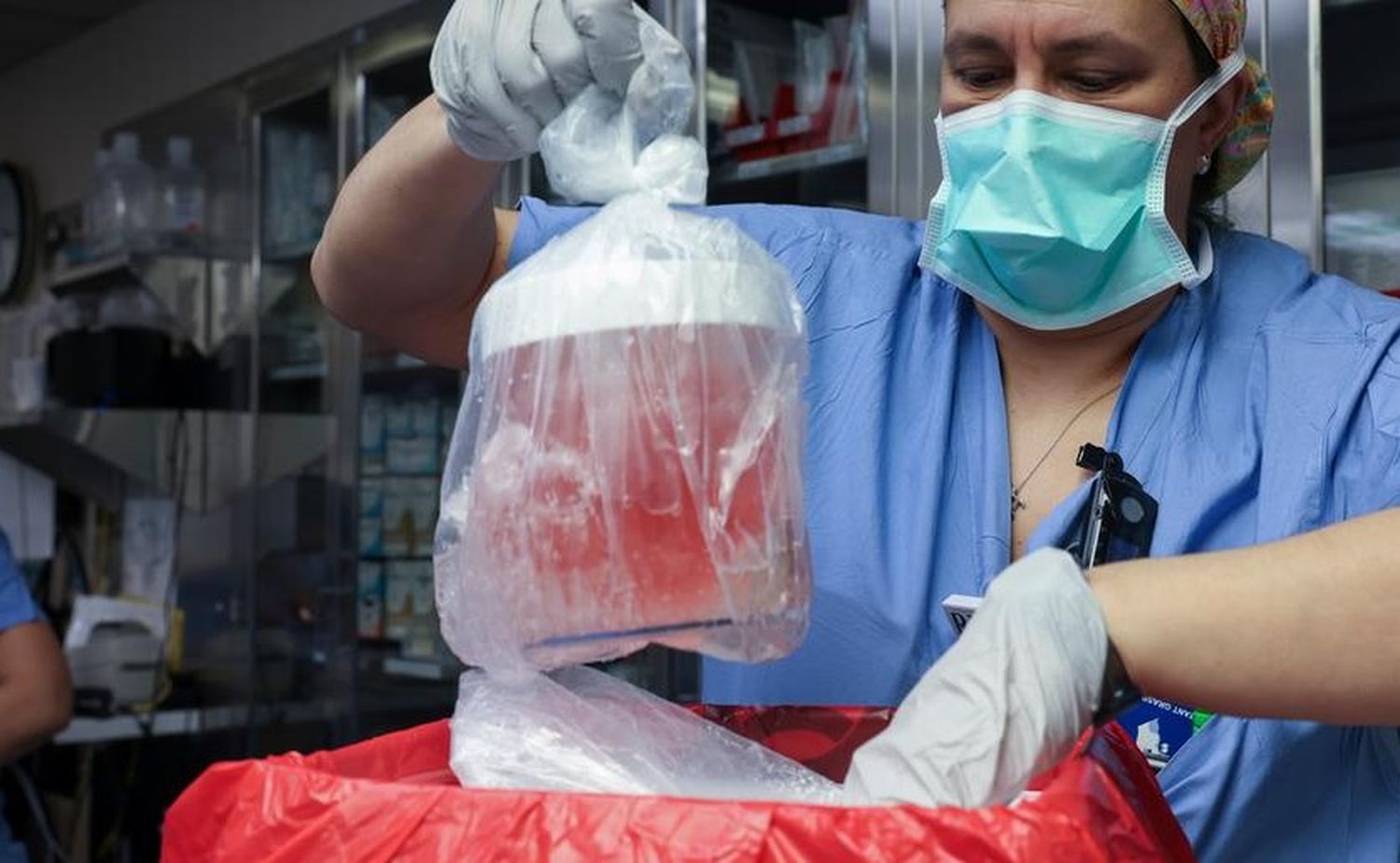 Una enfermera especialista saca el órgano de su caja de transporte para ser transplantado en el paciente.