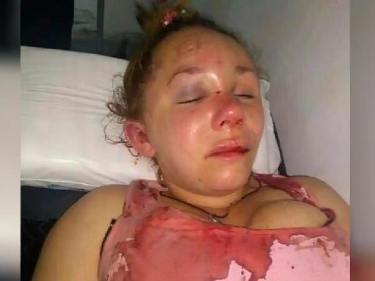 Río Segundo: golpeó salvajemente a su novia y se dio a la fuga