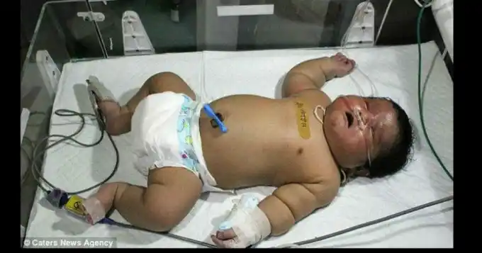 India: Nació un superbebé de siete kilos