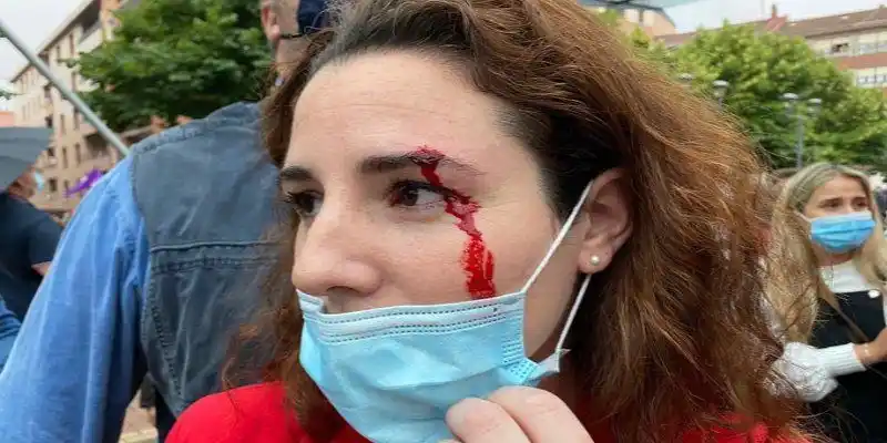 Diputada del VOX herida de una pedrada por radicales socialistas