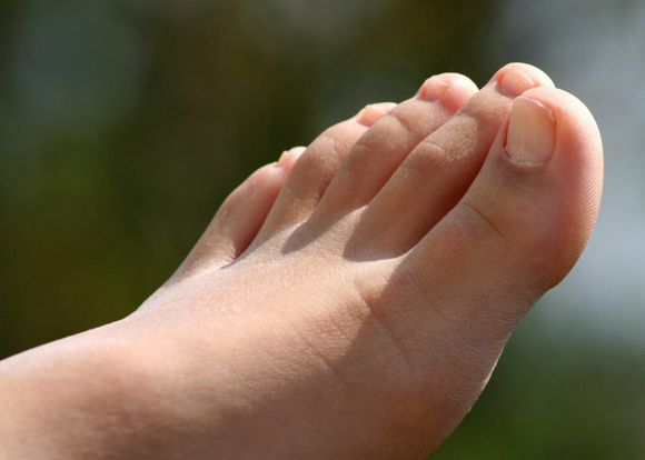¿Sufres de hongos en los pies? Estos remedios caseros te pueden interesar