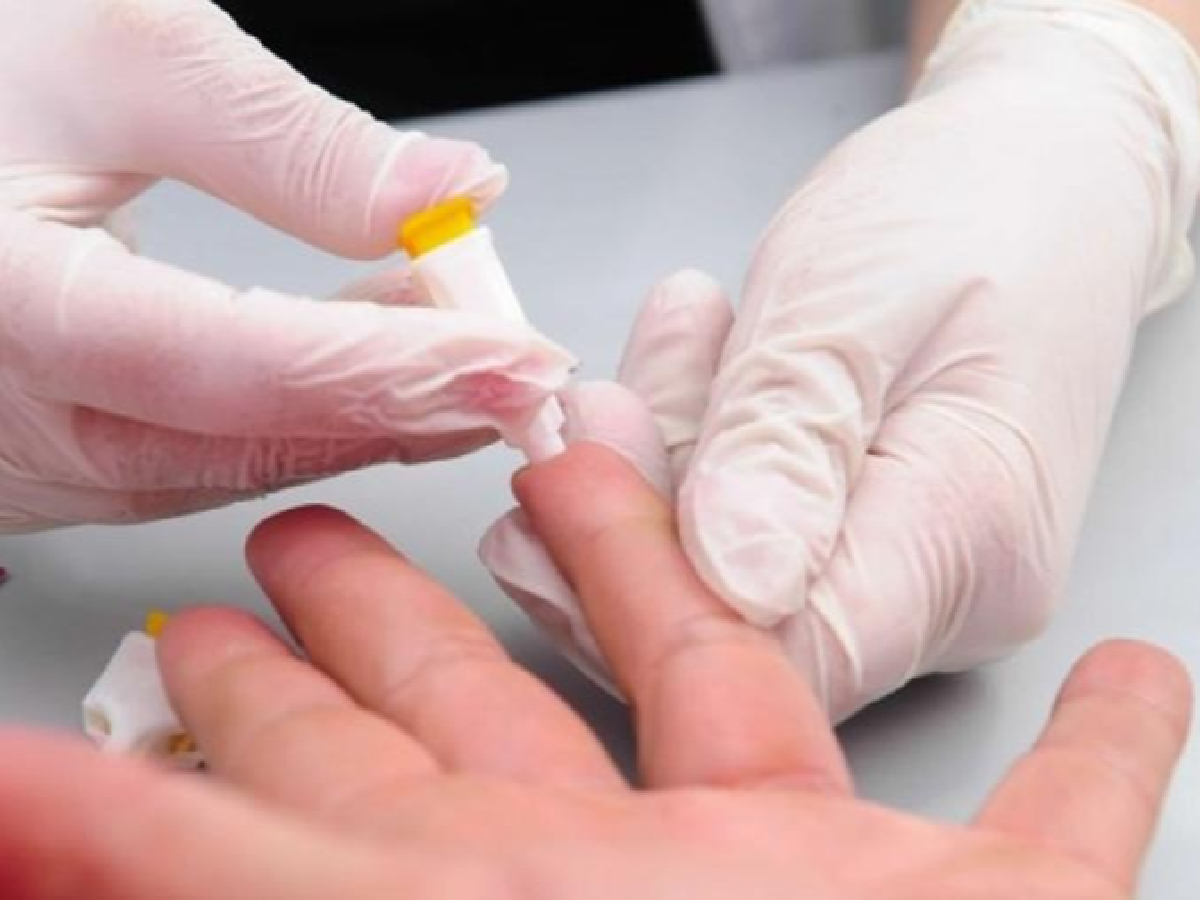 Confirman más de 420 casos de hepatitis aguda en niños y niñas en el mundo