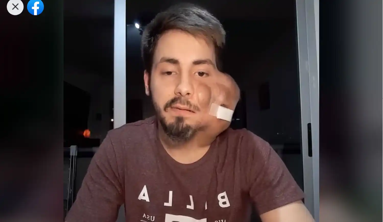 "Tengo 24 años y no me quiero morir": El desesperado pedido de un joven que necesita una prótesis de IOMA