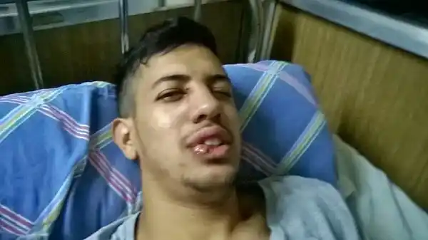 Futbolista hospitalizado tras una batalla campal en el ascenso