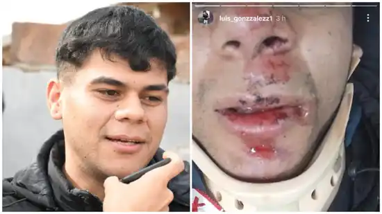 En Bahía Blanca lo conocen como el “Rey de las Picadas” y terminó internado tras chocar con un auto a gran velocidad