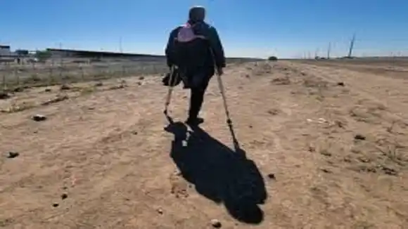 LA ODISEA del MIGRANTE VENEZOLANO que llegó a EE. UU. con una sola pierna: su sueño es conseguir una prótesis