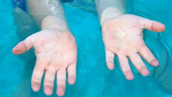 Fin del misterio: por qué se arrugan los dedos bajo el agua